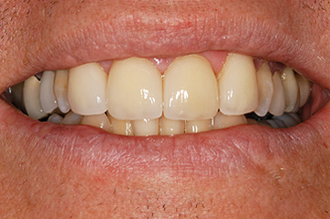 Cosmetic Dentist in Las Vegas