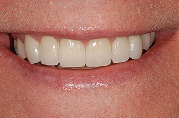 Las Vegas Cosmetic Dentist