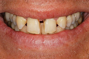 Cosmetic Dentist in Las Vegas