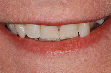 Las Vegas Cosmetic Dentist