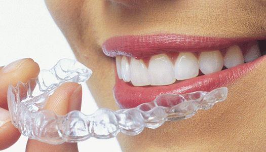 Invisalign Las Vegas